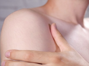 PRP Therapy for Shoulder Pain Thumbnail