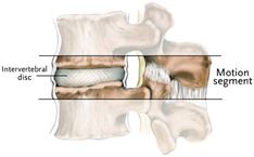 Spine Diagram