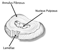 Intervertebral Disc